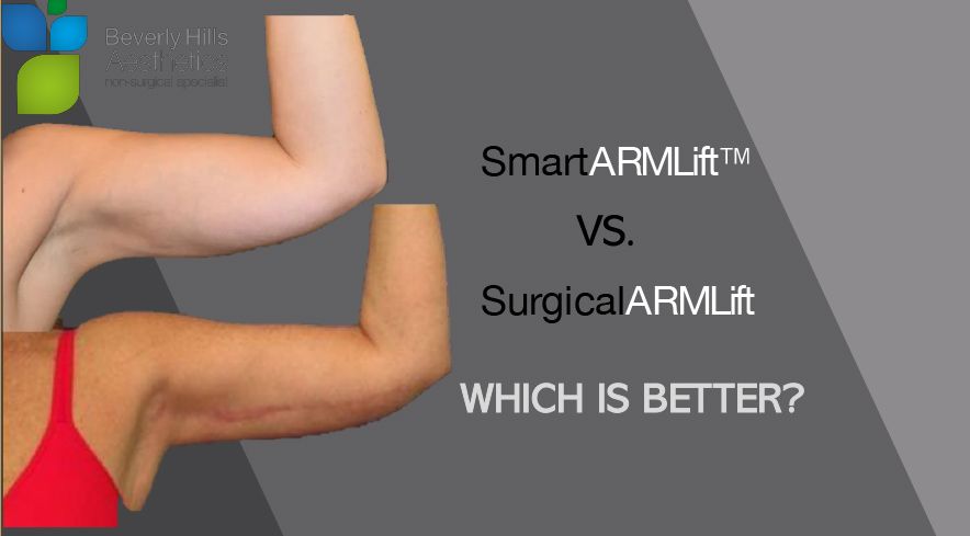 SmartARMLift ™ VS. SurgicalARMLift Which is better?
