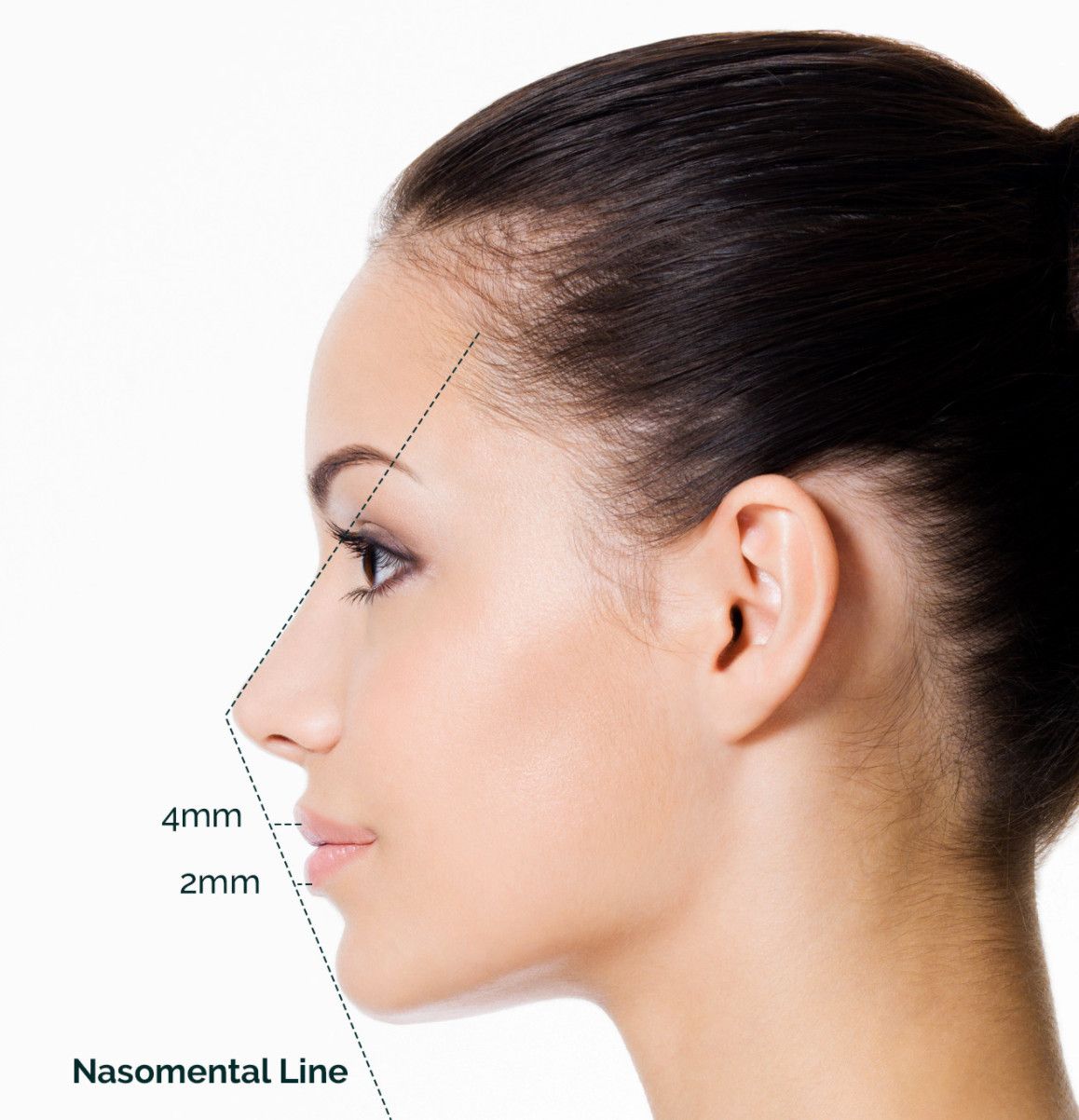 Profile of a woman with perfect facial proportions marked with nasomental line