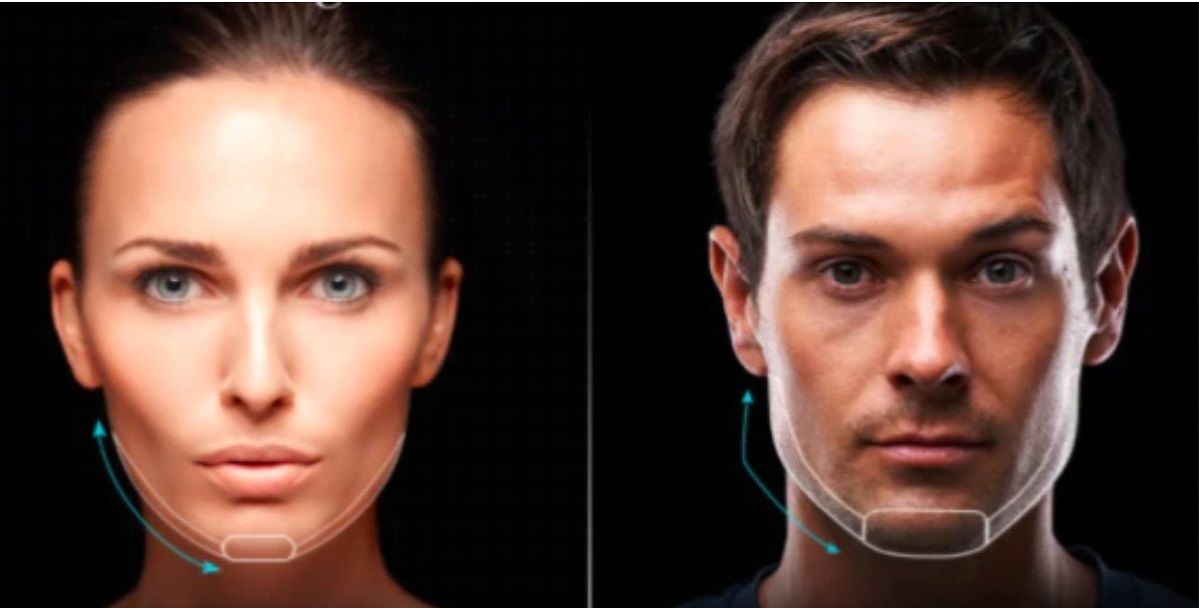 Female and male chin enhancement and jawline proportions