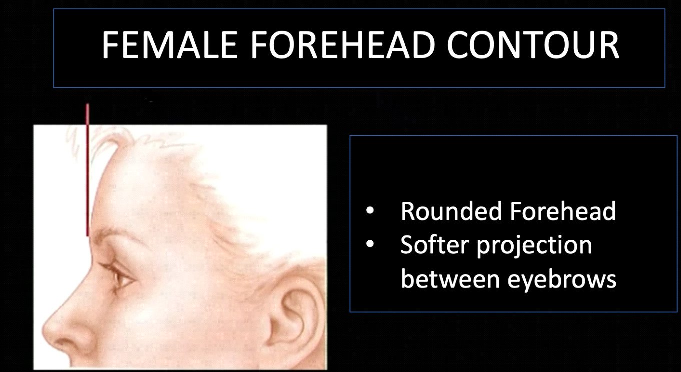 Female forehead contour: rounded forehead, softer projection between eyebrows