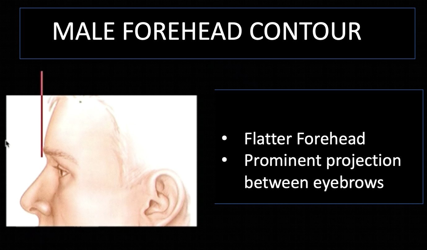 Male forehead contour: flatter forehead, prominent projection between eyebrows
