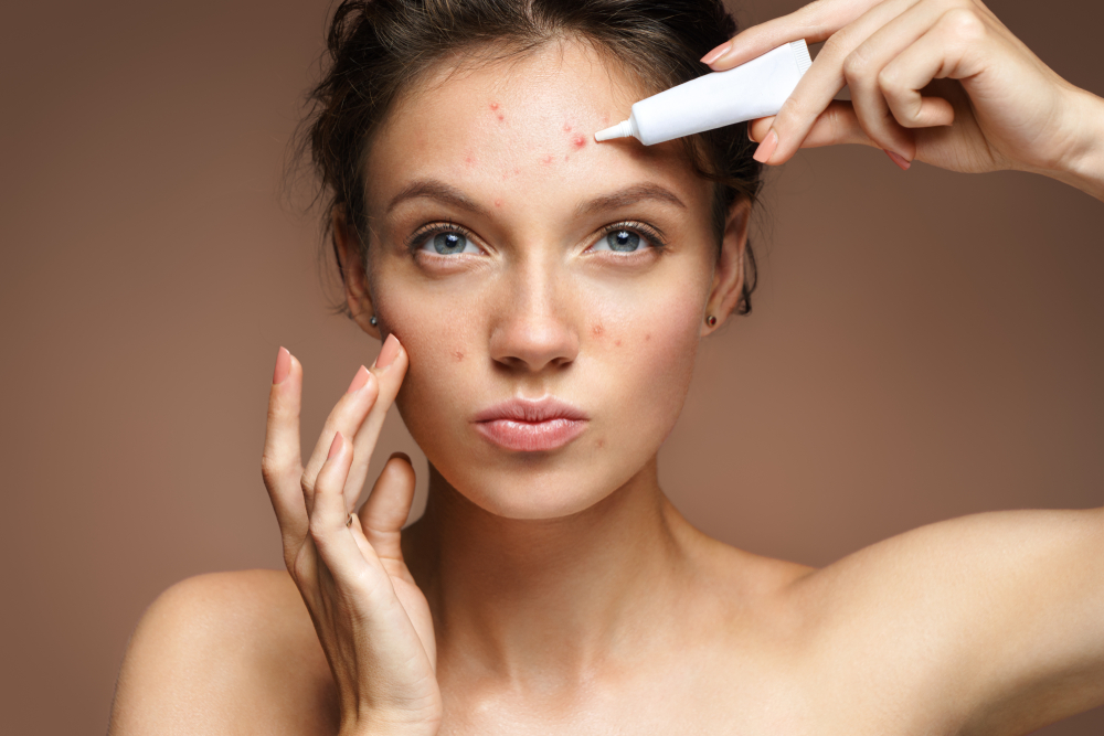 Does Corticosteroid Injection Treat Acne? Beverly Hills Aesthetics