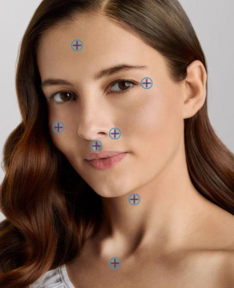 Restylane Skin Booster injection points